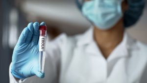 Refuerzan preparación de red de salud en O’Higgins ante alerta internacional por Ébola